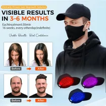 Red Light Laser Hair Growth Cap – Adjustable, Portable Hair Regrowth