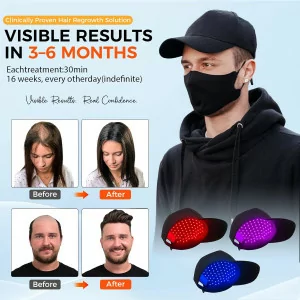 Red Light Laser Hair Growth Cap – Adjustable, Portable Hair Regrowth