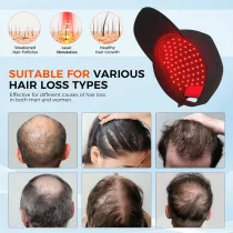 Red Light Laser Hair Growth Cap – Adjustable, Portable Hair Regrowth