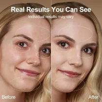 7-in-1 Red Light Face & Neck Massager | Portable 3-Color Skin Care Tool