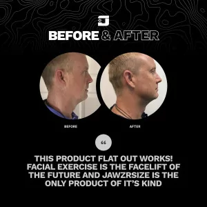 Jawzrsize Pop 'N Go: Tone Jaw, Neck & Face - Look Younger & Slimmer