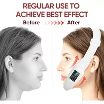 Intelligent Electric Double Chin & V-Face Machine | 8 Modes, 15 Intensities