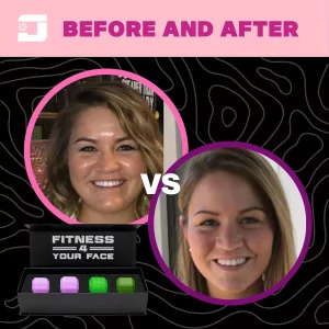 Jawzrsize Jaw Exerciser for Women – Double Chin Reducer & Facial Toner