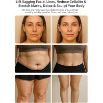 DiDEER 5-in-1 Body Sculpting Machine: Cellulite Removal & Skin Tightening