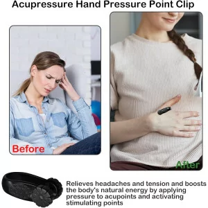 2Pcs Migraine Pressure Point Clips for Headache & Stress Relief - Acuplus