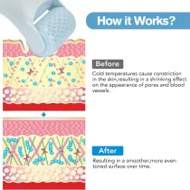 Ice Roller for Face & Eyes - Cooling Massager for Wrinkles & Puffiness