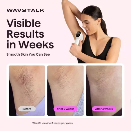 Wavytalk IPL Épilation Laser Painless Corps & Visage 12 Min