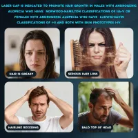 Laser Cap Rechargeable FDA : Traitement Chute de Cheveux