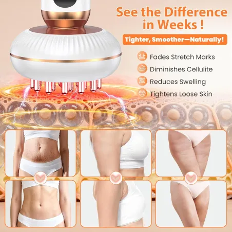 Appareil 4-en-1 Sculptant Corps : Anti-Cellulite & Drainage
