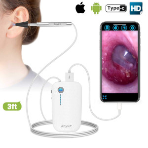 Wireless otoscope Anykit, look after the health of your ears at home