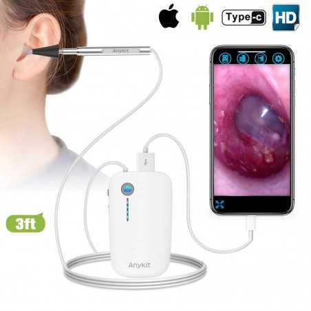 Wireless otoscope Anykit, look after the health of your ears at home