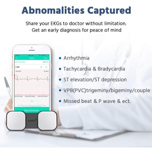 SnapECG Monitor, le moniteur sans fil