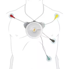 D-Heart, le moniteur ECG de poche