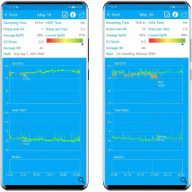 Moniteur de Sommeil LOOKEE® : Suivi Avancé du Bien-être Nocturne