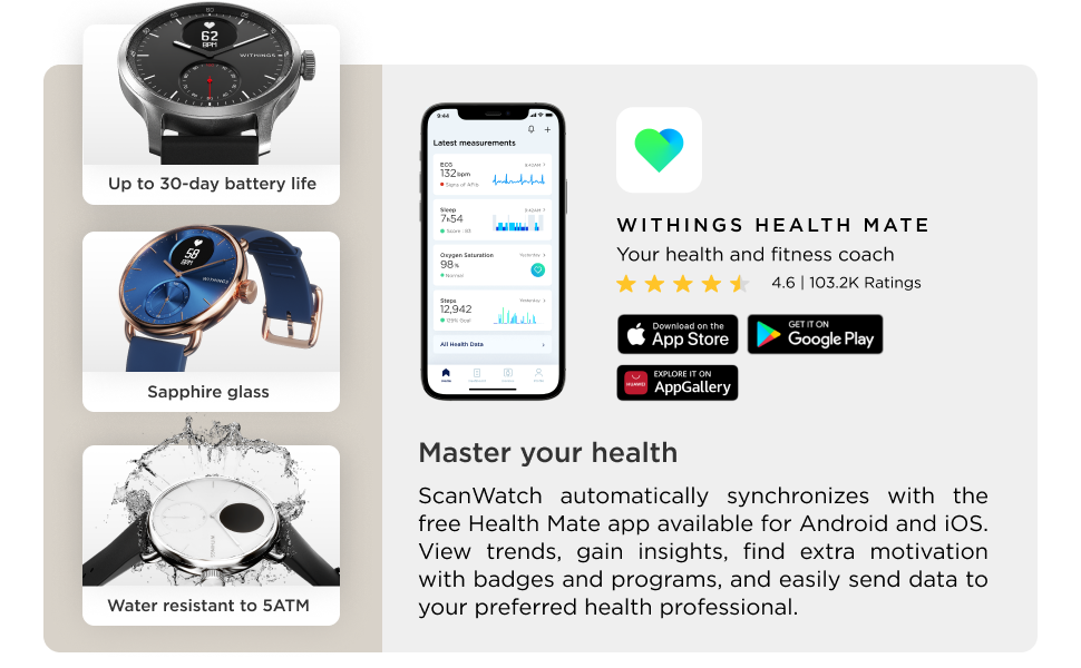 Scanwatch features