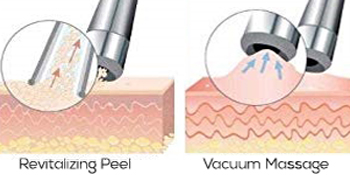 at home microdermabraison kit, hot rollers, microneedle roller, microblading, microdermabrasion kit