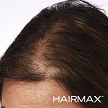 HairMax Laser Stimulation