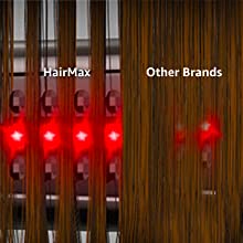 HairMax Laser Stimulation