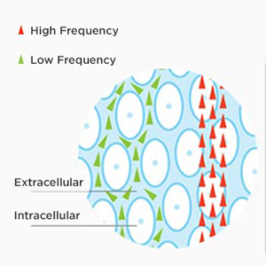 Bioelectrical Impedance Analysis (BIA) body composition intracellular extracellular status